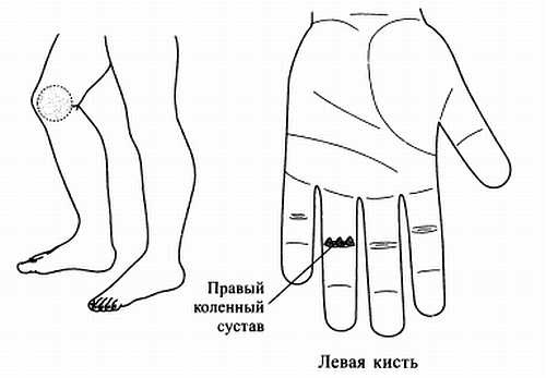 Иллюстрация к книге — Сам себе Су Джок доктор [_107.jpg]