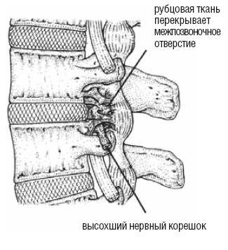 Настольная книга для тех, у кого болит спина