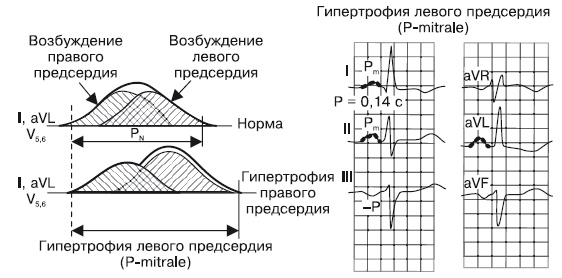 Иллюстрация к книге — Что показывает кардиограмма [i_015.jpg]