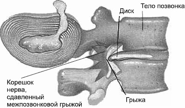Иллюстрация к книге — Заболевания позвоночника. Карманный справочник [_08.jpg]