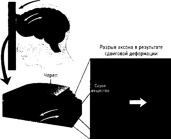 Иллюстрация к книге — Осторожно, спорт! О вреде бега, фитнеса и других физических нагрузок [img_15.jpg]