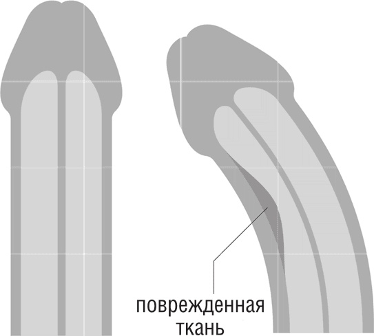 Иллюстрация к книге — ОН. Интимный разговор про тот самый орган [i_018.jpg]
