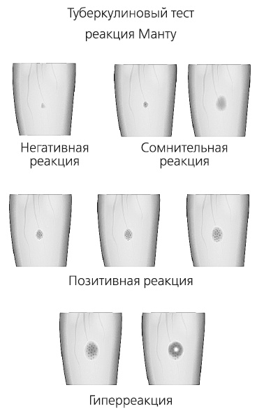 Иллюстрация к книге — Как работает иммунитет [i_047.jpg]