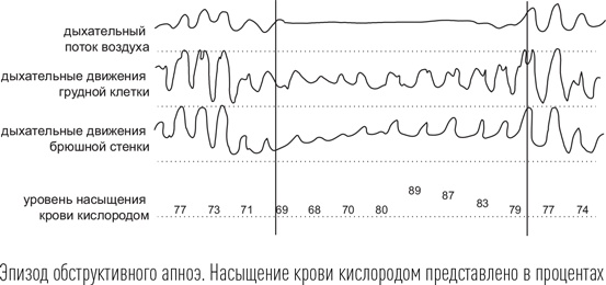 Иллюстрация к книге — Загадки сна [i_077.jpg]
