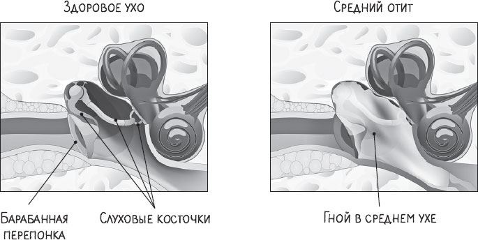 Иллюстрация к книге — В лабиринтах уха, горла и носа. Скрытые механизмы работы, неочевидные взаимосвязи и полезные знания, которые помогут «дотянуть» до визита к врачу [i_006.jpg]
