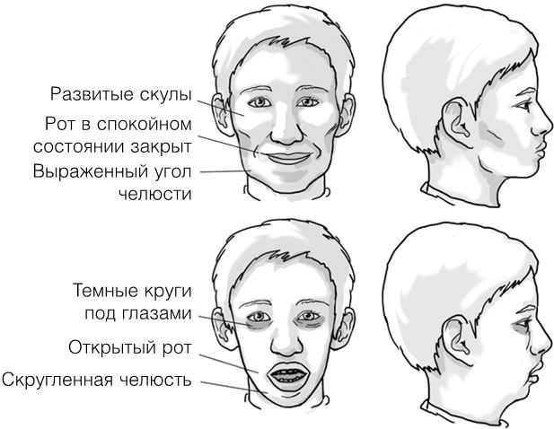 Иллюстрация к книге — Челюсти. Научное исследование о взаимосвязи между зубами, мозгом и кишечником + 40-дневный план питания, который поможет вернуть в норму здоровье ротовой полости и сформировать иммунитет к кариесу [i_015.jpg]