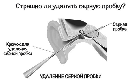 Иллюстрация к книге — Почему болит ухо. Что делать при отитах, снижении слуха и звоне в ушах – правила доказательной медицины [i_031.jpg]