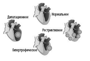 Иллюстрация к книге — Взламывая анатомию [image118.jpg]