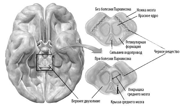 Иллюстрация к книге — Взламывая анатомию [image162.jpg]
