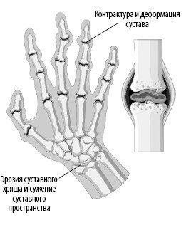 Иллюстрация к книге — Взламывая анатомию [image87.jpg]