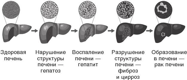 Иллюстрация к книге — О чем молчит печень. Как уловить сигналы самого крупного внутреннего органа, который предпочитает оставаться в тени [i_012.jpg]