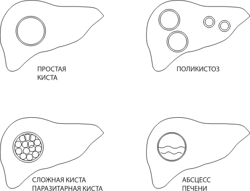 Иллюстрация к книге — О чем молчит печень. Как уловить сигналы самого крупного внутреннего органа, который предпочитает оставаться в тени [i_089.jpg]
