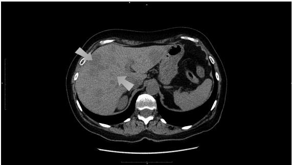 Иллюстрация к книге — О чем молчит печень. Как уловить сигналы самого крупного внутреннего органа, который предпочитает оставаться в тени [i_099.jpg]