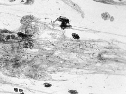 Homo Viridae: человек как вирус Homo Viridae: человек как вирус