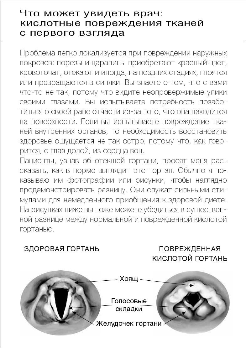 Иллюстрация к книге — Как вылечить изжогу, кашель, воспаление, аллергию, ГЭРБ : программа снижения кислотности за 28 дней [i_009.jpg]