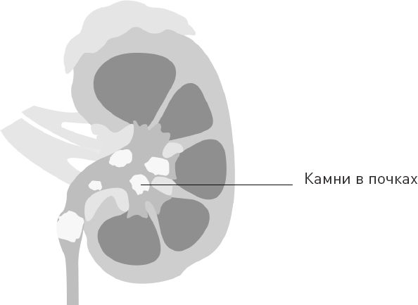 Иллюстрация к книге — Лжецы. Как врачи обманываются сами и невольно обманывают пациентов [i_068.jpg]