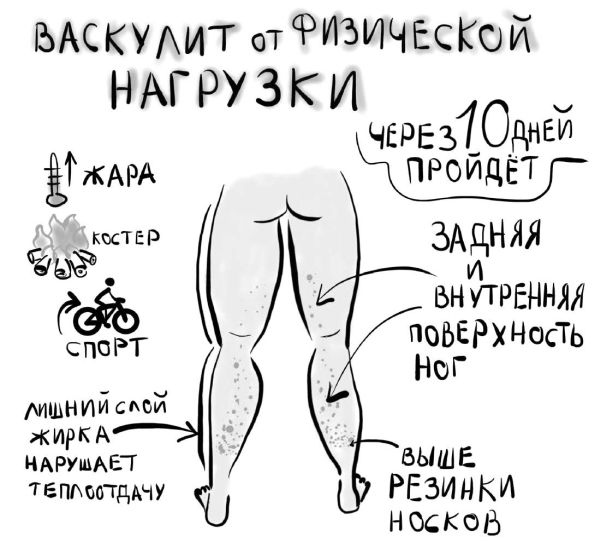 Иллюстрация к книге — PRO здоровье. Перевод с медицинского на человеческий [i_019.jpg]