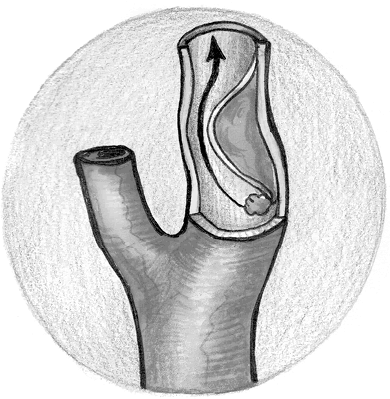 Иллюстрация к книге — Хрупкий мозг. Инсульту не быть? [img_30.jpg]