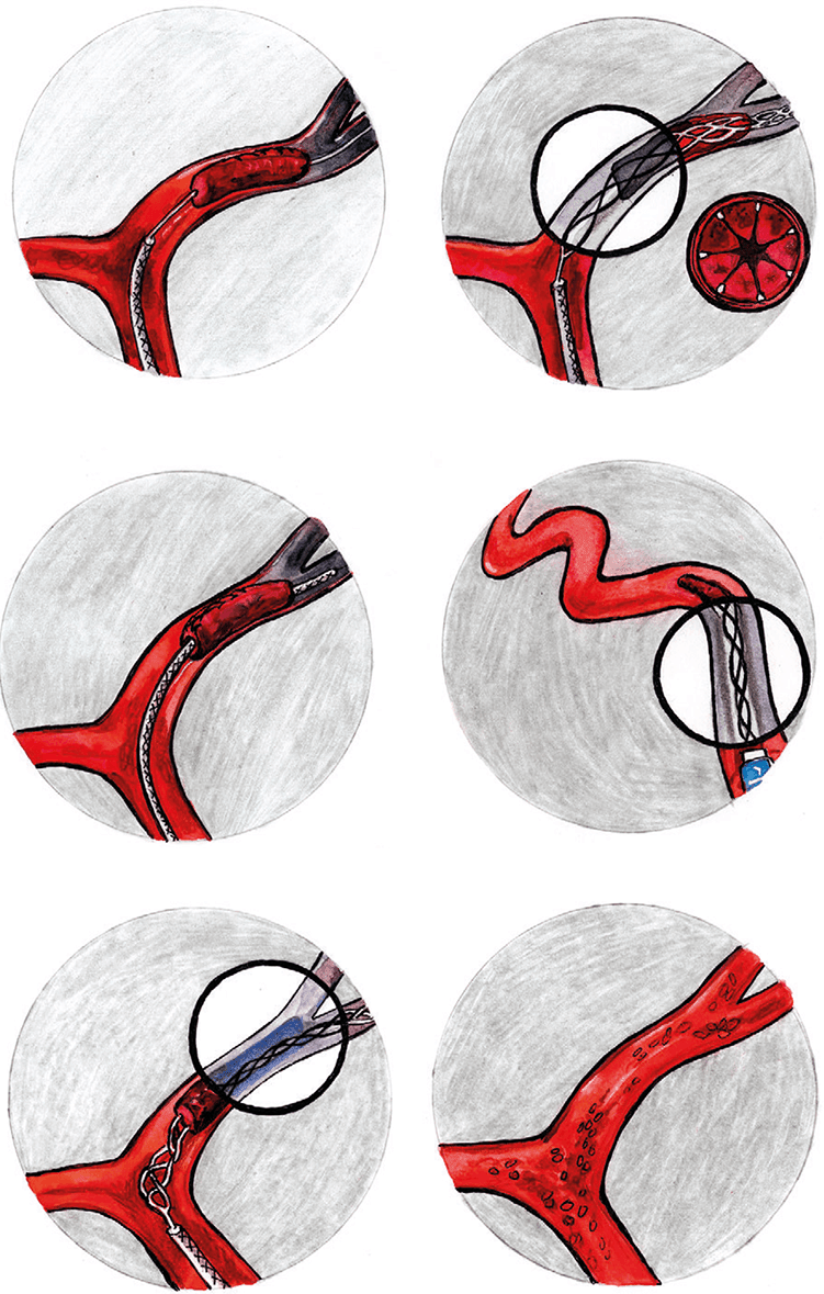 Иллюстрация к книге — Хрупкий мозг. Инсульту не быть? [img_33.jpg]