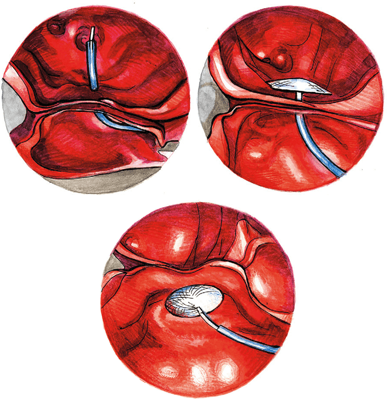 Иллюстрация к книге — Хрупкий мозг. Инсульту не быть? [img_46.jpg]