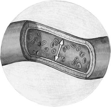 Иллюстрация к книге — Хрупкий мозг. Инсульту не быть? [img_56.jpg]