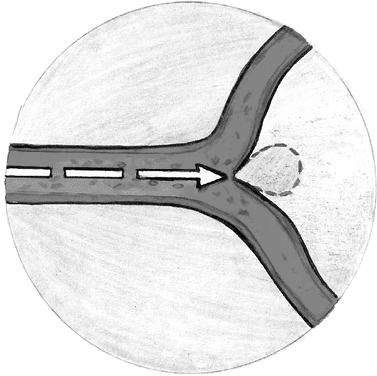 Иллюстрация к книге — Хрупкий мозг. Инсульту не быть? [img_70.jpg]
