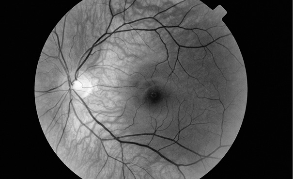 Иллюстрация к книге — Живой мозг. Удивительные факты о нейропластичности и возможностях мозга [img_47.jpg]