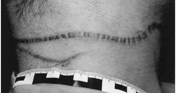 Иллюстрация к книге — Сыны Сэма. Убийцы влюбленных парочек [book-illustration-53.webp]